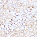ACAT1 Polyclonal Antibody