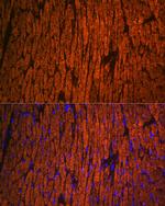 MYL2 Polyclonal Antibody