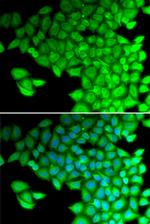 MYL2 Antibody in Western Blot (WB)