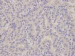 ALDH3A1 Polyclonal Antibody