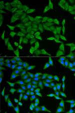 CRABP2 Polyclonal Antibody