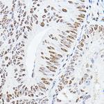GAS41 Polyclonal Antibody