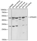 ATP6IP2 Polyclonal Antibody