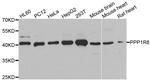 PPP1R8 Polyclonal Antibody
