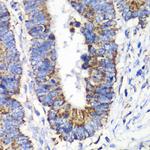 RALB Polyclonal Antibody