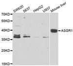 ASGR1 Polyclonal Antibody