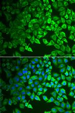 GIF Polyclonal Antibody