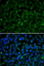 GPI Polyclonal Antibody