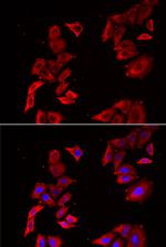 MEK5 Polyclonal Antibody