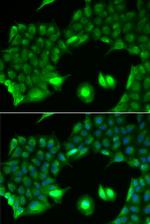 SSX2 Polyclonal Antibody