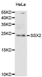 SSX2 Antibody in Western Blot (WB)