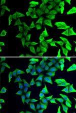VSNL1 Antibody in Western Blot (WB)