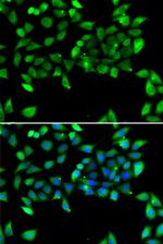 eIF3h Polyclonal Antibody