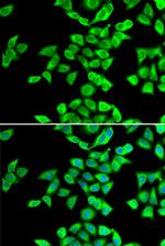 NMT2 Polyclonal Antibody