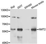 NMT2 Antibody in Western Blot (WB)
