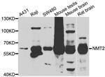 NMT2 Antibody in Western Blot (WB)