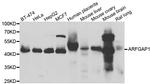 ARFGAP1 Antibody in Western Blot (WB)