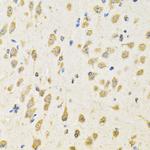 PTPRE Polyclonal Antibody