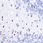 GOLPH2 Antibody in Immunohistochemistry (Paraffin) (IHC (P))