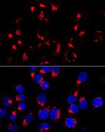 GOLPH2 Polyclonal Antibody