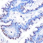 GOLPH2 Antibody in Immunohistochemistry (Paraffin) (IHC (P))