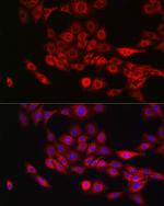 Annexin A11 Polyclonal Antibody