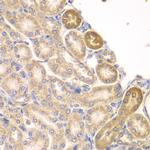 PIP4K2A Antibody in Immunohistochemistry (Paraffin) (IHC (P))