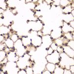 PIP4K2A Antibody in Immunohistochemistry (Paraffin) (IHC (P))