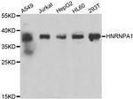hnRNP A1 Polyclonal Antibody