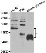FCGR2B Polyclonal Antibody