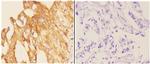 PIK3CG Antibody in Immunohistochemistry (Paraffin) (IHC (P))