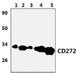 BTLA Polyclonal Antibody