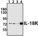 IL18R1 Polyclonal Antibody