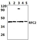 RFC2 Polyclonal Antibody