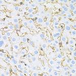 INSR Antibody in Immunohistochemistry (Paraffin) (IHC (P))