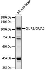 GluR2 Polyclonal Antibody