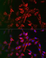 LRP5 Polyclonal Antibody