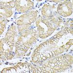 alpha-II Spectrin Antibody in Immunohistochemistry (Paraffin) (IHC (P))