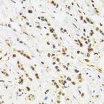 RAD50 Polyclonal Antibody