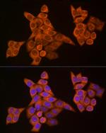 Caspase 8 Antibody in Immunocytochemistry (ICC/IF)