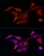 DOK4 Antibody in Immunocytochemistry (ICC/IF)