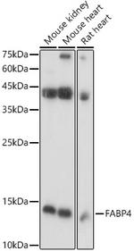 FABP4 Antibody in Western Blot (WB)