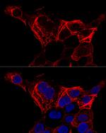 Cytokeratin 20 Antibody in Immunocytochemistry (ICC/IF)