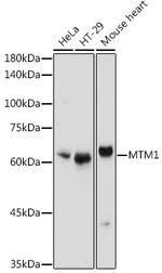 MTM1 Polyclonal Antibody