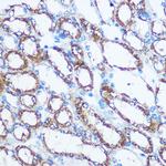 NME1 Polyclonal Antibody