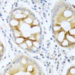 PKC alpha Antibody in Immunohistochemistry (Paraffin) (IHC (P))