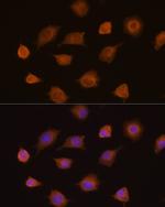 PKM2 Polyclonal Antibody