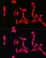 SOD1 Polyclonal Antibody