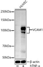 VCAM-1 Polyclonal Antibody