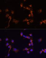 c-Abl Polyclonal Antibody